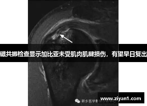 磁共振检查显示加比亚未受肌肉肌腱损伤，有望早日复出